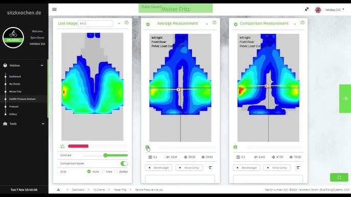 Capteur Velometrik - Analyse des pressions de selle par R.Flow